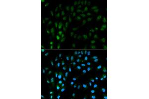 Immunofluorescence analysis of MCF7 cell using TFPI antibody. (TFPI 抗体)
