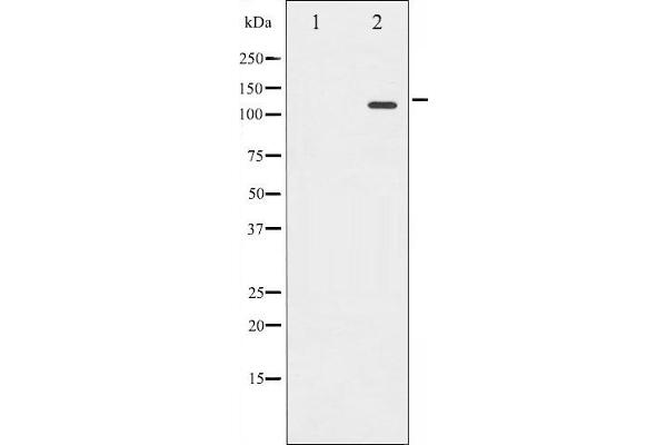 Retinoblastoma 1 抗体  (pSer780)