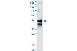 Immunoprecipitation of TTC1 transfected lysate using rabbit polyclonal anti-TTC1 and Protein A Magnetic Bead (TTC1 (人) IP-WB Antibody Pair)