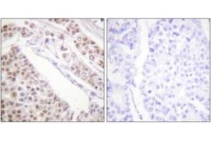 Immunohistochemistry (IHC) image for anti-Histone H2B (acLys12) antibody (ABIN2890727) (Histone H2B 抗体  (acLys12))