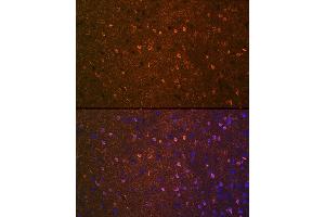 Immunofluorescence analysis of mouse brain using BDNF Rabbit mAb (ABIN7265916) at dilution of 1:100 (40x lens). (BDNF 抗体)