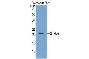 Western Blotting (WB) image for anti-Killer Cell Lectin-Like Receptor Subfamily D, Member 1 (KLRD1) (AA 32-179) antibody (ABIN1859565) (CD94 抗体  (AA 32-179))