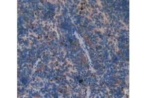 IHC-P analysis of spleen tissue, with DAB staining. (GDF3 抗体  (AA 253-366))