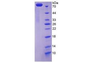 Image no. 1 for ATPase, Ca++ Transporting, Cardiac Muscle, Slow Twitch 2 (ATP2A2) (AA 315-756) protein (His tag,GST tag) (ABIN4990542) (ATP2A2 Protein (AA 315-756) (His tag,GST tag))