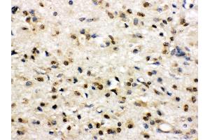 Immunohistochemistry (Paraffin-embedded Sections) (IHC (p)) image for anti-Discs, Large Homolog 4 (Drosophila) (DLG4) (AA 581-724) antibody (ABIN3043563) (DLG4 抗体  (AA 581-724))