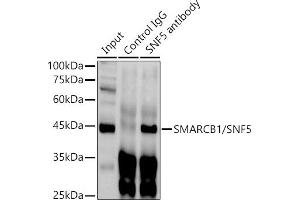 Immunoprecipitation analysis of 300 μg extracts of HeLa cells using 3 μg SM/SNF5 antibody . (SMARCB1 抗体  (AA 77-376))