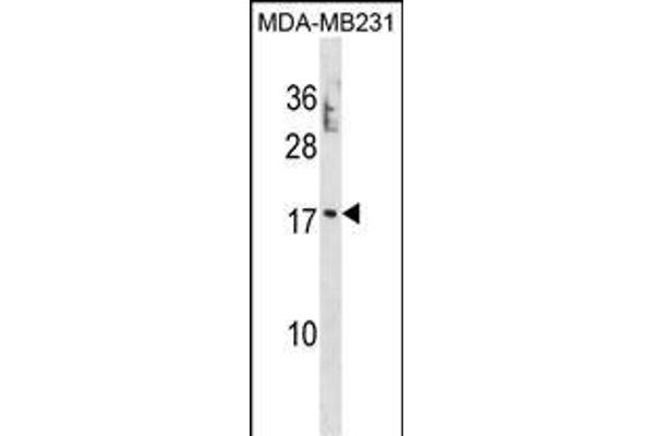 PTRH2 抗体  (N-Term)