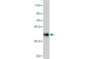 Western Blotting (WB) image for anti-S100 Calcium Binding Protein A6 (S100A6) (AA 1-90) antibody (ABIN562771)