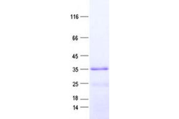 EMC10 Protein (His tag)