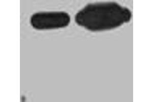 Western blot analysis of Recombinant Nano-Tag9 Protein with Nano-Tag9 Mouse mAb diluted at 1)1:10,000,2)1:5,000 (Nano-Tag 抗体)