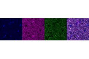 Immunohistochemistry (IHC) image for anti-ATP Synthase, H+ Transporting, Mitochondrial F1 Complex, alpha Subunit 1, Cardiac Muscle (ATP5A1) antibody (ABIN7456080)