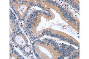 Immunohistochemistry (IHC) image for anti-Growth Differentiation Factor 11 (GDF11) antibody (ABIN2434352) (GDF11 抗体)