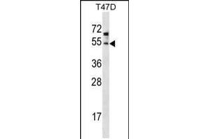 Western blot analysis in T47D cell line lysates (35ug/lane). (ZDHHC6 抗体  (C-Term))