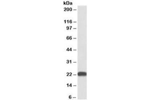 Western blot testing of human liver lysate with BLVRB antibody at 0. (BLVRB 抗体)
