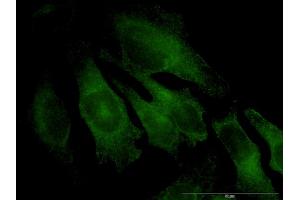 Immunofluorescence of monoclonal antibody to TRAPPC4 on HeLa cell. (TRAPPC4 抗体  (AA 1-219))