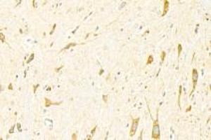 Immunohistochemistry analysis of paraffin-embedded mouse spinal cord using ADAMTS4 (ABIN7072947) at dilution of 1: 3000 (ADAMTS4 抗体)