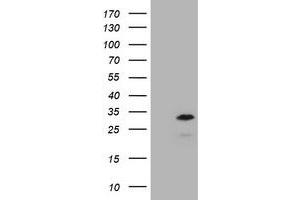 Image no. 1 for anti-Membrane-Spanning 4-Domains, Subfamily A, Member 1 (MS4A1) antibody (ABIN1497209) (CD20 抗体)