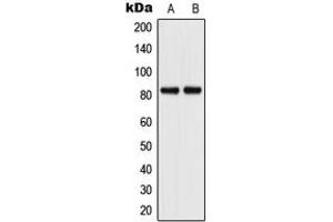 Western blot analysis of CD106 expression in A549 (A), HuvEc (B) whole cell lysates. (VCAM1 抗体  (Center))