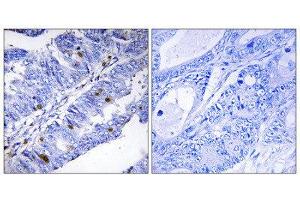 Immunohistochemistry (IHC) image for anti-Nuclear Receptor Subfamily 4, Group A, Member 1 (NR4A1) (pSer351) antibody (ABIN1847422) (NR4A1 抗体  (pSer351))