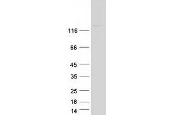 OTOA Protein (Transcript Variant 1) (Myc-DYKDDDDK Tag)