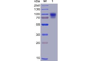 Human SIRPα, hFc-His Tag on SDS-PAGE under reducing condition. (SIRPA Protein (AA 31-373) (Fc-His Tag))