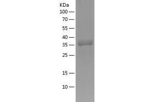 Western Blotting (WB) image for Caveolin 1, Caveolae Protein, 22kDa (CAV1) (AA 2-104) protein (His-IF2DI Tag) (ABIN7122185) (Caveolin-1 Protein (AA 2-104) (His-IF2DI Tag))