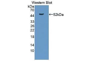 Western Blotting (WB) image for anti-Lipopolysaccharide Binding Protein (LBP) antibody (Biotin) (ABIN1174580) (LBP 抗体  (Biotin))