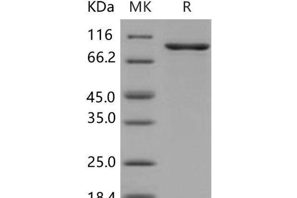 CHEK2 Protein (GST tag,His tag)