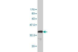 Western Blotting (WB) image for anti-Centrin, EF-Hand Protein, 3 (CETN3) (AA 1-100) antibody (ABIN560341)