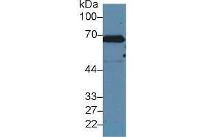 Detection of CK2 in Human A431 cell lysate using Polyclonal Antibody to Keratin 2 (CK2) (Keratin 2 抗体  (AA 508-685))