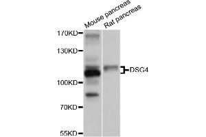 Western blot analysis of extracts of various cell lines, using DSG4 antibody (ABIN5997626) at 1/1000 dilution. (Desmoglein 4 抗体)