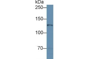 Detection of NOS2 in Mouse Cerebellum lysate using Polyclonal Antibody to Nitric Oxide Synthase 2, Inducible (NOS2) (NOS2 抗体  (AA 526-659))