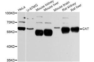 Western blot analysis of extracts of various cell lines, using CAT Antibody (ABIN5997374) at 1:3000 dilution. (Catalase 抗体)
