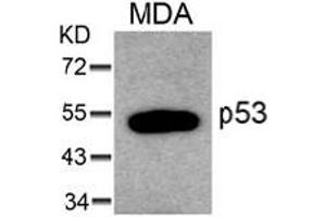 Image no. 1 for anti-Tumor Protein P53 (TP53) (AA 4-8) antibody (ABIN319299) (p53 抗体  (AA 4-8))