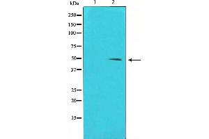 Western blot analysis of Cyclin E1 phosphorylation expression in Paclitaxel treated HeLa whole cell lysates,The lane on the left is treated with the antigen-specific peptide. (Cyclin E1 抗体  (pThr395))