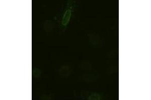 Immunofluorescence (IF) image for anti-Interleukin 6 (IL6) (AA 29-212) antibody (ABIN1491342) (IL-6 抗体  (AA 29-212))