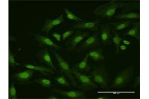 Immunofluorescence of purified MaxPab antibody to HHEX on HeLa cell. (HHEX 抗体  (AA 1-270))