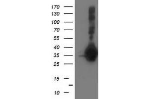 Western Blotting (WB) image for anti-Sirtuin 5 (SIRT5) antibody (ABIN1500933) (SIRT5 抗体)