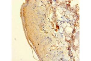 Immunohistochemistry of paraffin-embedded human adrenal gland tissue using HTR2A Antibody at dilution 1:100. (HTR2A 抗体  (AA 385-471))