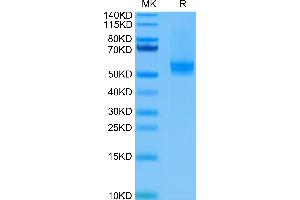 Human BAFF Trimer on Tris-Bis PAGE under reduced condition. (BAFF Protein (Trimer) (His-DYKDDDDK Tag))