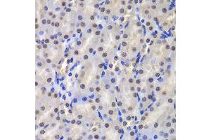 Immunohistochemistry of paraffin-embedded mouse kidney using GSTP1 antibody at dilution of 1:200 (400x lens). (GSTP1 抗体)