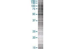 SLC39A13 transfected lysate. (SLC39A13 293T Cell Transient Overexpression Lysate(Denatured))