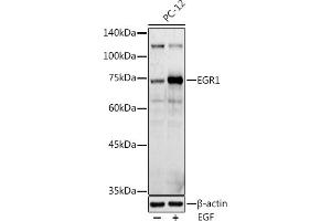 Western blot analysis of extracts of PC-12 cells, using EGR1 antibody (ABIN6133683, ABIN6139992, ABIN7101807 and ABIN7101808) at 1:1000 dilution. (EGR1 抗体  (AA 1-250))