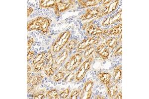 Immunohistochemistry of paraffin embedded rat kidney using Megalin (ABIN7074514) at dilution of 1:1000 (400x lens) (LRP2 抗体)