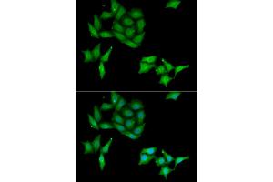 Immunofluorescence analysis of HeLa cells using CCNC antibody. (Cyclin C 抗体)