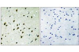 Immunohistochemistry analysis of paraffin-embedded human brain tissue, using MAD4 antibody. (MXD4 抗体  (N-Term))