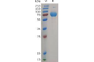 IFNGR2 Protein (AA 28-247) (Fc Tag)