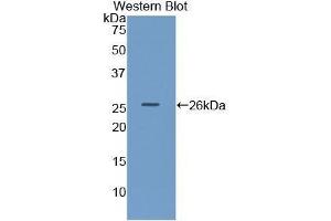 Western Blotting (WB) image for anti-Lipase, Hepatic (LIPC) (AA 25-247) antibody (ABIN1859670) (LIPC 抗体  (AA 25-247))