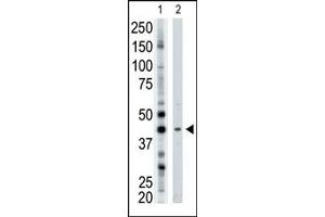 Image no. 1 for anti-ADP-Ribosyltransferase 3 (ART3) (N-Term) antibody (ABIN357663) (ART3 抗体  (N-Term))