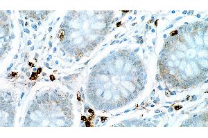 Human colon: immunohistochemical staining for Interleukin 6. (IL-6 抗体  (N-Term))